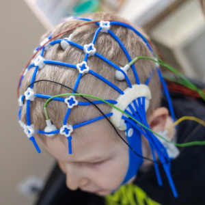 ELETROENCEFALOGRAMA (EEG) – AVALIAÇÃO DA ATIVIDADE CEREBRAL