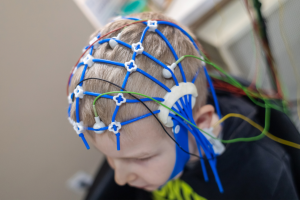 ELETROENCEFALOGRAMA (EEG) – AVALIAÇÃO DA ATIVIDADE CEREBRAL