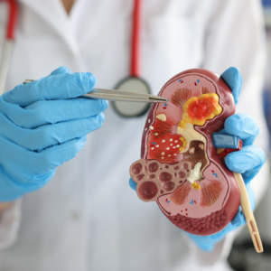 UREIA – AVALIAÇÃO DA FUNÇÃO RENAL