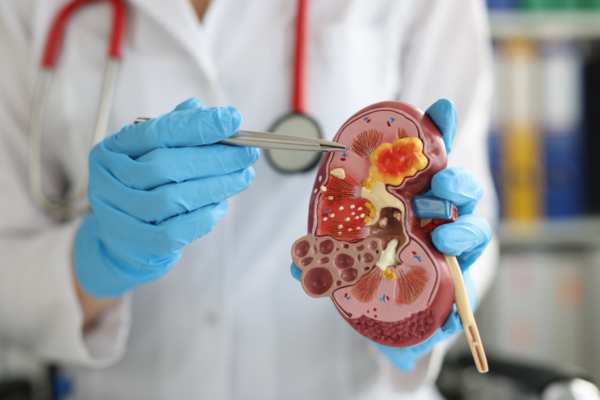 UREIA – AVALIAÇÃO DA FUNÇÃO RENAL