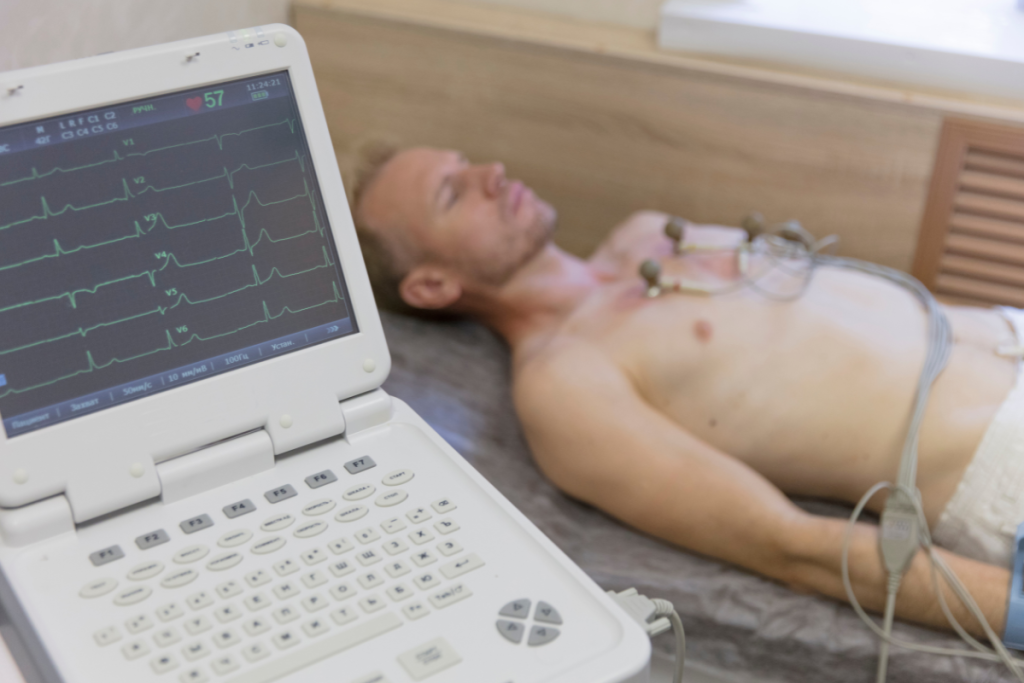 ELETROCARDIOGRAMA